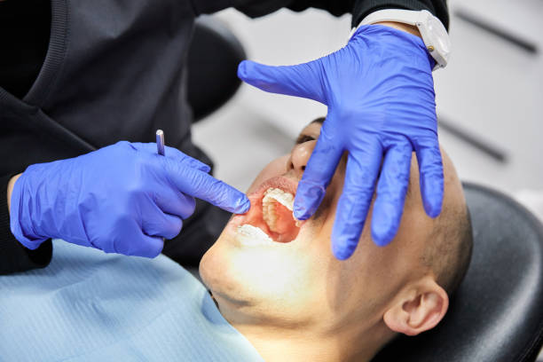 Best Cracked Tooth Emergency Dentist  in Burgin, KY